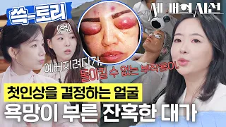 [세 개의 시선] 예뻐지고 싶었을 뿐인데💉 충격적인 피부 시술의 부작용 #세개의시선