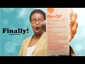 Bio-oil Review what i found after trying it for 2 weeks