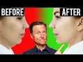 Download Lagu Fastest Way to Rid Your DOUBLE CHIN (Turkey Neck)