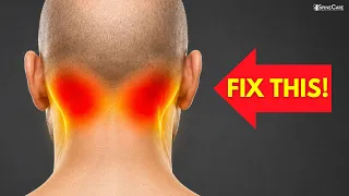 How to Fix Base of Skull Pain FAST