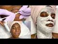 Deep Cleansing Oxygen Facial Close Up Extractions