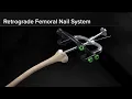 Retrograde Femoral Nail System Surgical Technique