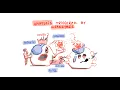 Natural Killer Cells and Antibody Dependent Cellular Cytotoxicity ADCC