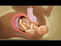 Download Lagu Stuck Shoulders (Spanish) - Childbirth Series