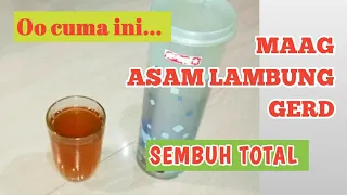 resep jitu obat maag asam lambung dan gerd