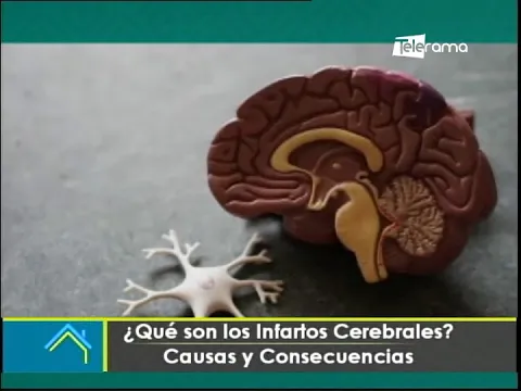 ¿Qué son los infartos cerebrales? Causas y consecuencias