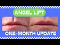 Angellift One-Month Update