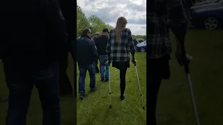 amputee girl