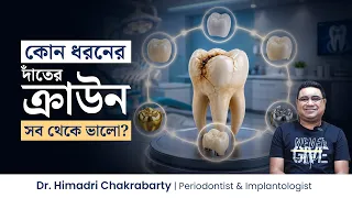কোন ধরনের ক্রাউন সব থেকে ভালো? জিরকোনিয়া, ই-ম্যাক্স, পিএফএম, মেটালের মধ্যে কোনটি সবচেয়ে ভালো?