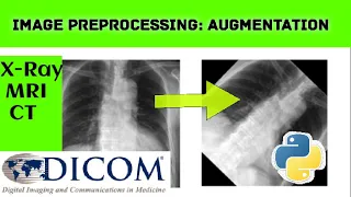 Image preprocessing how to do augmentation python programming ITFO