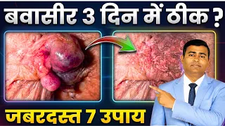 बवासीर 3 दिन में ठीक? 😱 डॉक्टर ने बताए 7 असरदार उपाय | Piles Treatment #piles