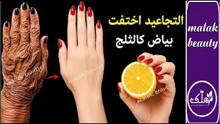 يديك تبدو مثل العجوز ‼️ ليمونة واحدة‼️هتتخلصي من اسمرار وتجاعيد الايد نهائيا ‼️من اول مرة