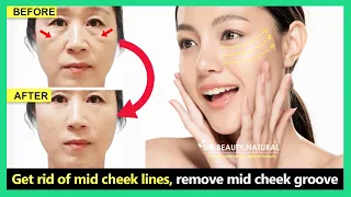 Download Mid Face Lift | Get rid of mid cheek lines, remove midface wrinkles with Face exercise \u0026 massage MP3