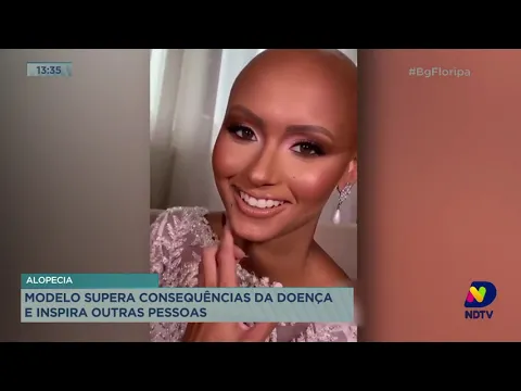 Superando desafios: modelo inspira na luta contra a alopecia