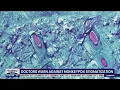 Doctors warn against monkeypox stigmatization FOX 13 Seattle