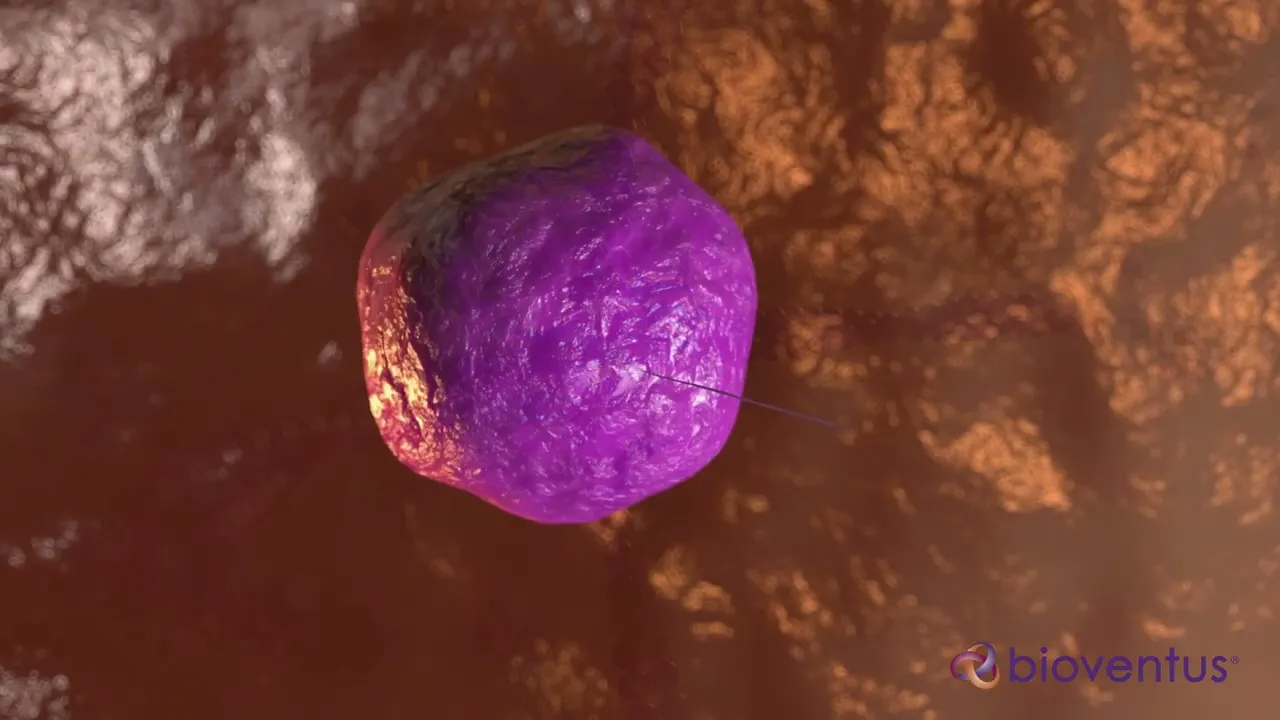 Bioventus 3D medical animation video