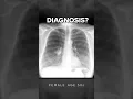 Download Lagu Female in her 50s presents with cough. What does it show? Explanation on main channel #radiology MP3