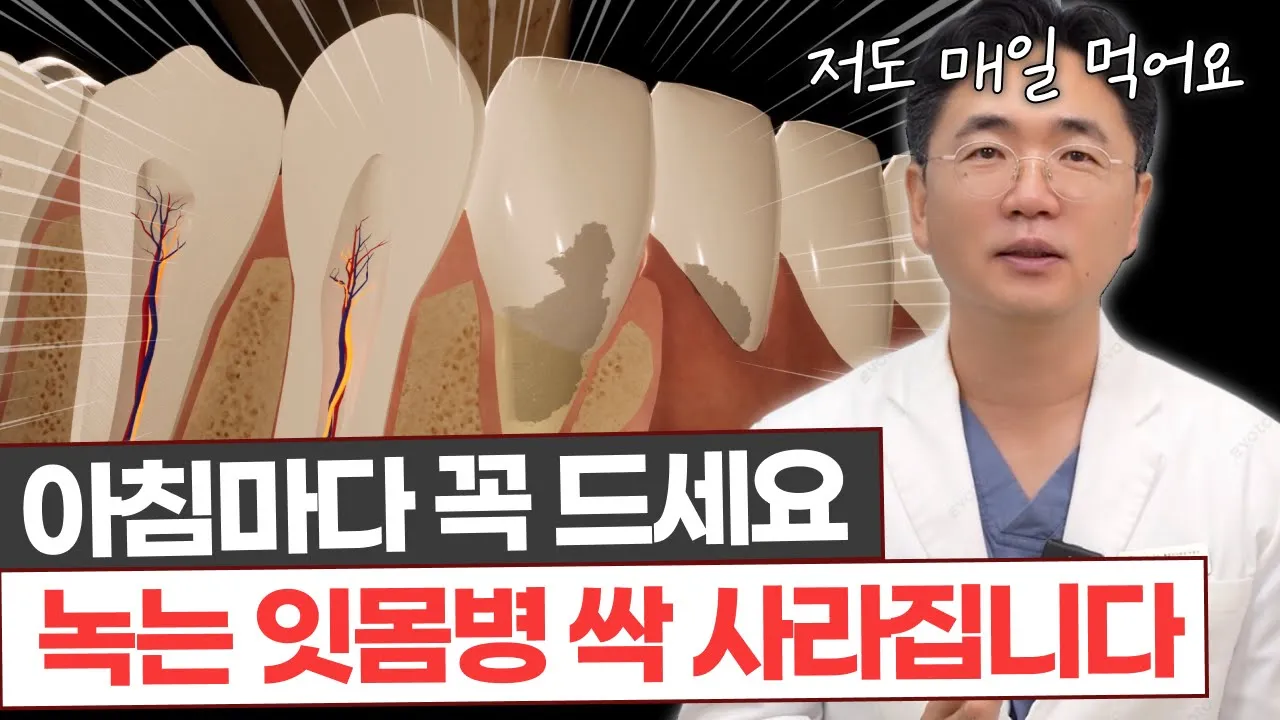 치과의사가 알려주는 잇몸 망치는 음식들!