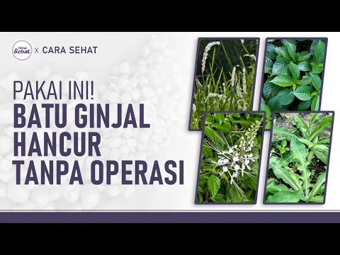 Cara Alami Meluruhkan Batu Ginjal, Tanpa Operasi!