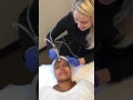 Hydrafacial - Step 1 Cleanse and Exfoliate