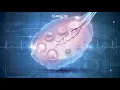 Download Lagu Understanding Premature Ovarian Insufficiency