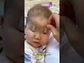 Why do Chinese apply Tape on their Children s Eyes
