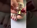 Correct and Care Ingrown Toenail Straightening and Pedicure Tools
