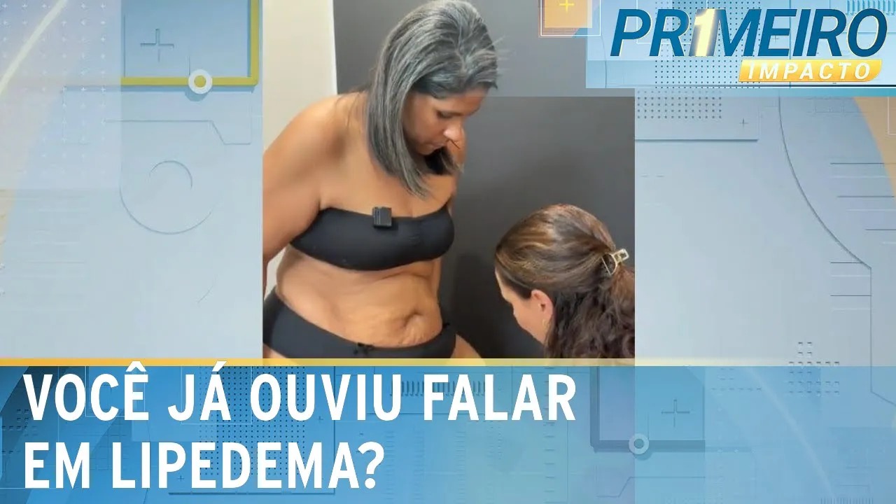 ONG financia cirurgia de paciente de forma inédita no Brasil | Primeiro Impacto (27/10/23)