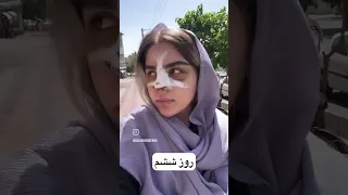 پست سحر دماغش رو عمل کرده سحر حسینی دماغ نو ترند عشق و نفرت چالش زیبا مبارک اکس دیت کلیپ 