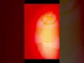 Download Lagu I NEED A DOCTOR. SUBLIMINAL PART 2 #listen #music #musicstreaming#bipolardisorderawareness#Dr Dre