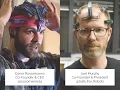 The Open Source Neuro Tech Revolution OpenBCI Founder Q A Live Demo Consciousness Hacking SF