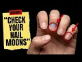 What Your Fingernail Moons Are REALLY Saying About Your Health