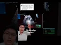Download Lagu Hamil 5 minggu di USG seperti apa?