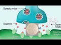Rexulti Brexpiprazole a Medication for Major Depression Schizophrenia Agitation in Dementia