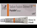 Fucidin Ointment uses in Hindi Sodium Fusidate Ointment Fucidin Cream