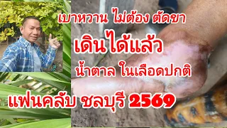 เบาหวานไม่ต้องตัดขาน้ำตาลในเลือดปกติเดินได้แล้ว@สมุนไพร#โจฮักนะสารคาม #ลุงโจสมุนไพรEP.1775