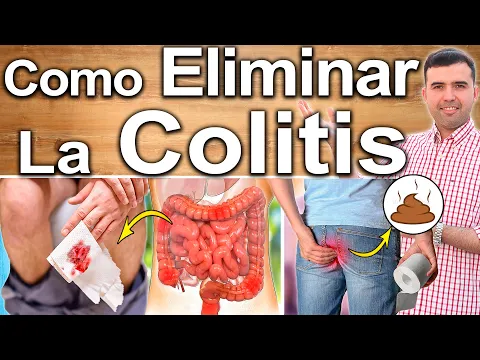 Download MP3 CÓMO ELIMINAR LA COLITIS? - Soluciones Avanzadas Para Curar La Colitis Ulcerativa