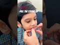 Easy 3 steps - how to pull a loose tooth