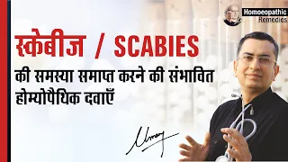 स्केबीज़ || Scabies|| Natural Homeopathic remedies || होम्योपैथिक उपचार