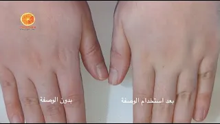 وصفة تبييض البشرة فعالة من أول استعمال
