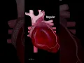 Download Lagu Heart Arrhythmias: Different Types and Symptoms