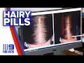 New pill to treat hair loss Nine News Australia