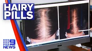 New pill to treat hair loss Nine News Australia