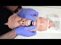 Jaw Thrust