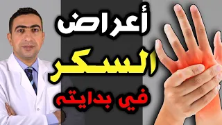 أعراض مرض السكر في بدايته 