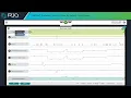 CoPilot Summary Graph How to Adjust Time Views RJG Tutorial