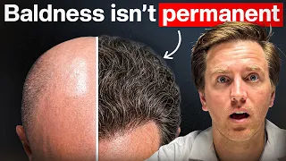 Why I Believe a Slick-Bald Scalp Can Grow Hair Again Sooner Than You Think