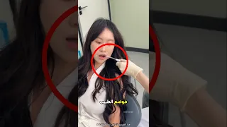 وضع طبيب الأسنان الأنبوب في فم الفتاة ولكن Shorts  وضع طبيب الأسنان الأنبوب في فم الفتاة ولكن Shorts