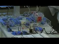 VERIFY Here s what donating plasma does to your antibody levels