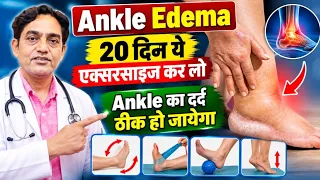 Ankle Pain + Swelling का इलाज | 5 तरीके से सूजन कम करें 